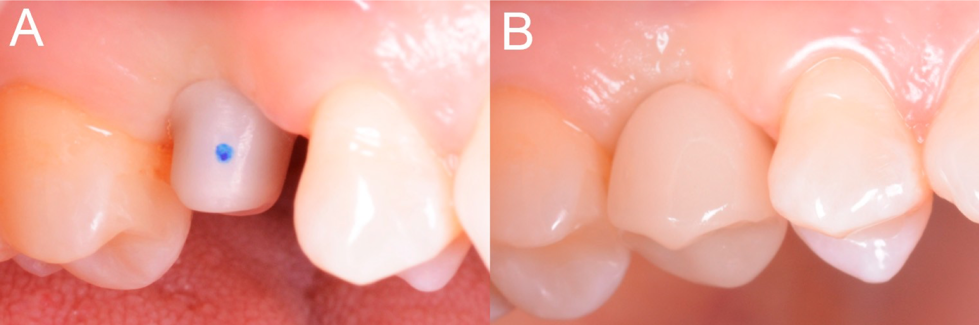 Figure13